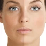 کدام روش ها برای روشن سازی پوست بهتر است؟