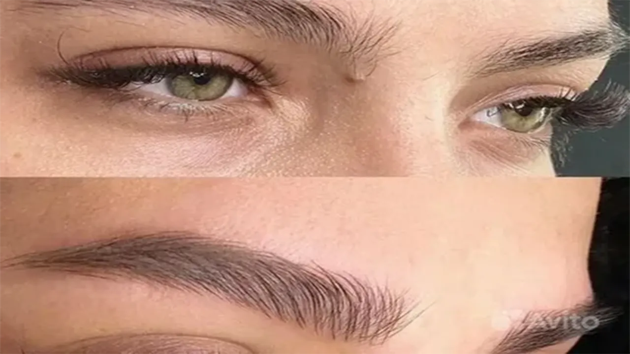 فیبروز ابرو در اصفهان