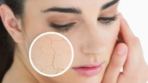 چه تفاوت هایی بین پوست خشک و کم آب وجود دارد؟