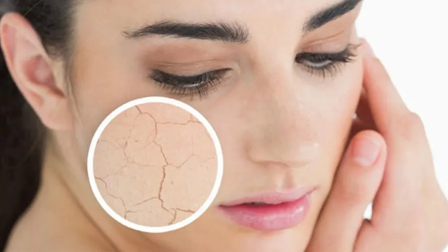چه تفاوت هایی بین پوست خشک و کم آب وجود دارد؟