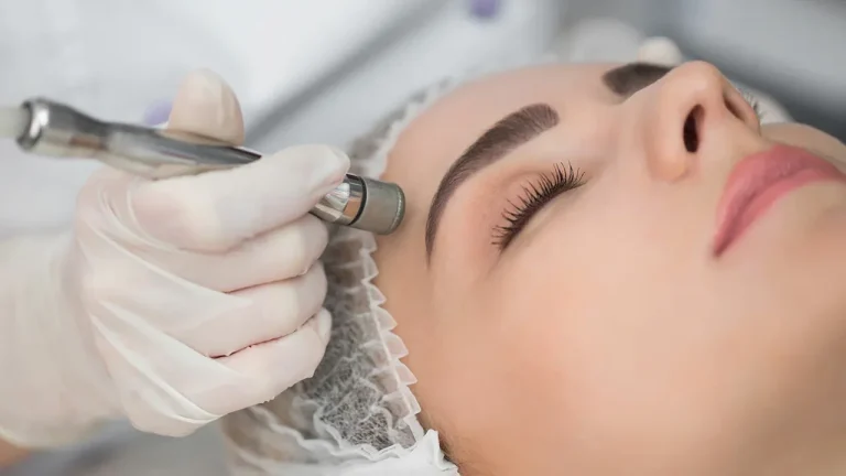 خدمات میکرودرم ابریژن در اصفهان